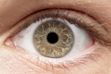 Cornea Update: Corneal Dystrophies & Related Conditions with an Update on Genetic Assessment and Treatment