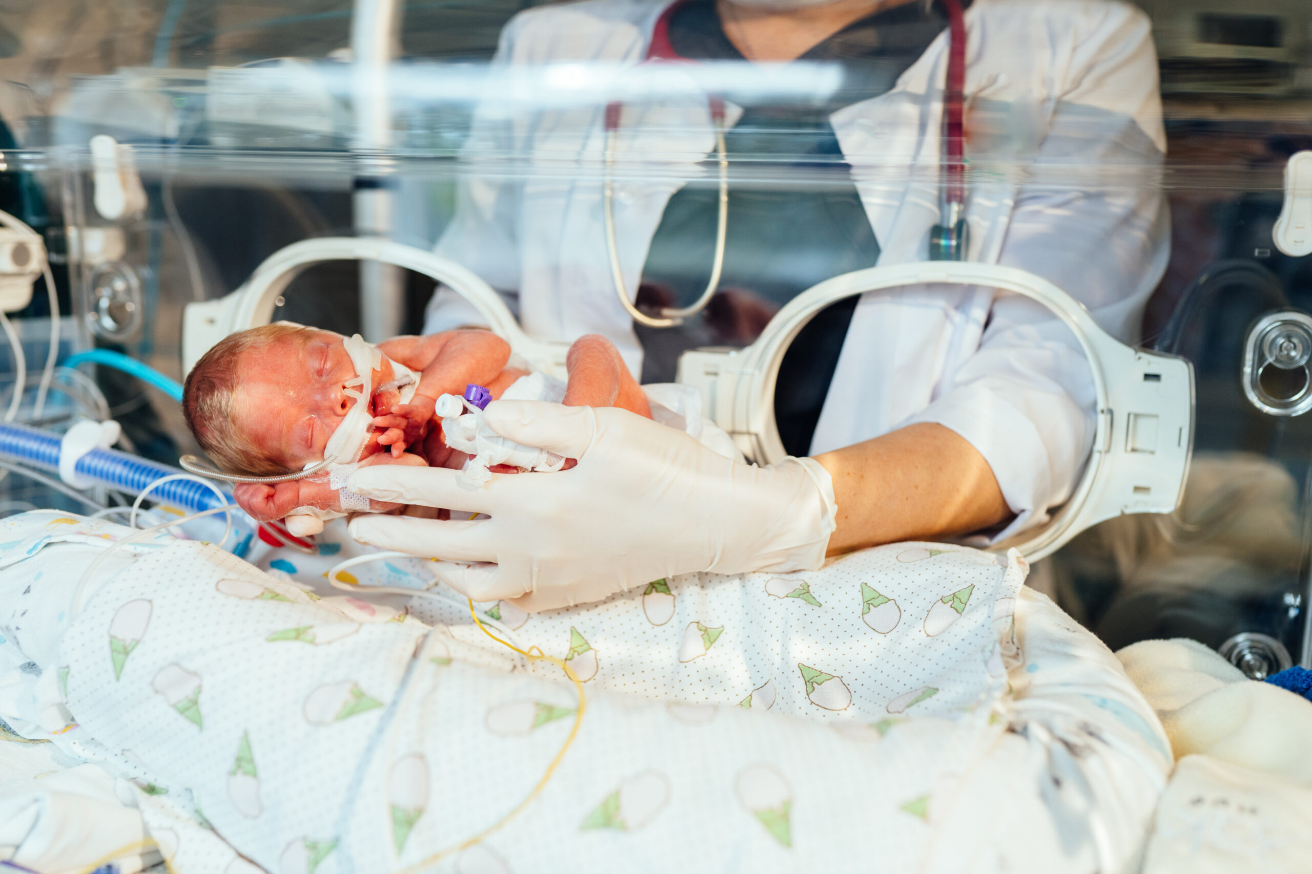 Unrecognizable nurse in white gloves takes action and care for premature baby, selective focus on baby eye. Newborn is placed in the incubator. Neonatal intensive care unit.