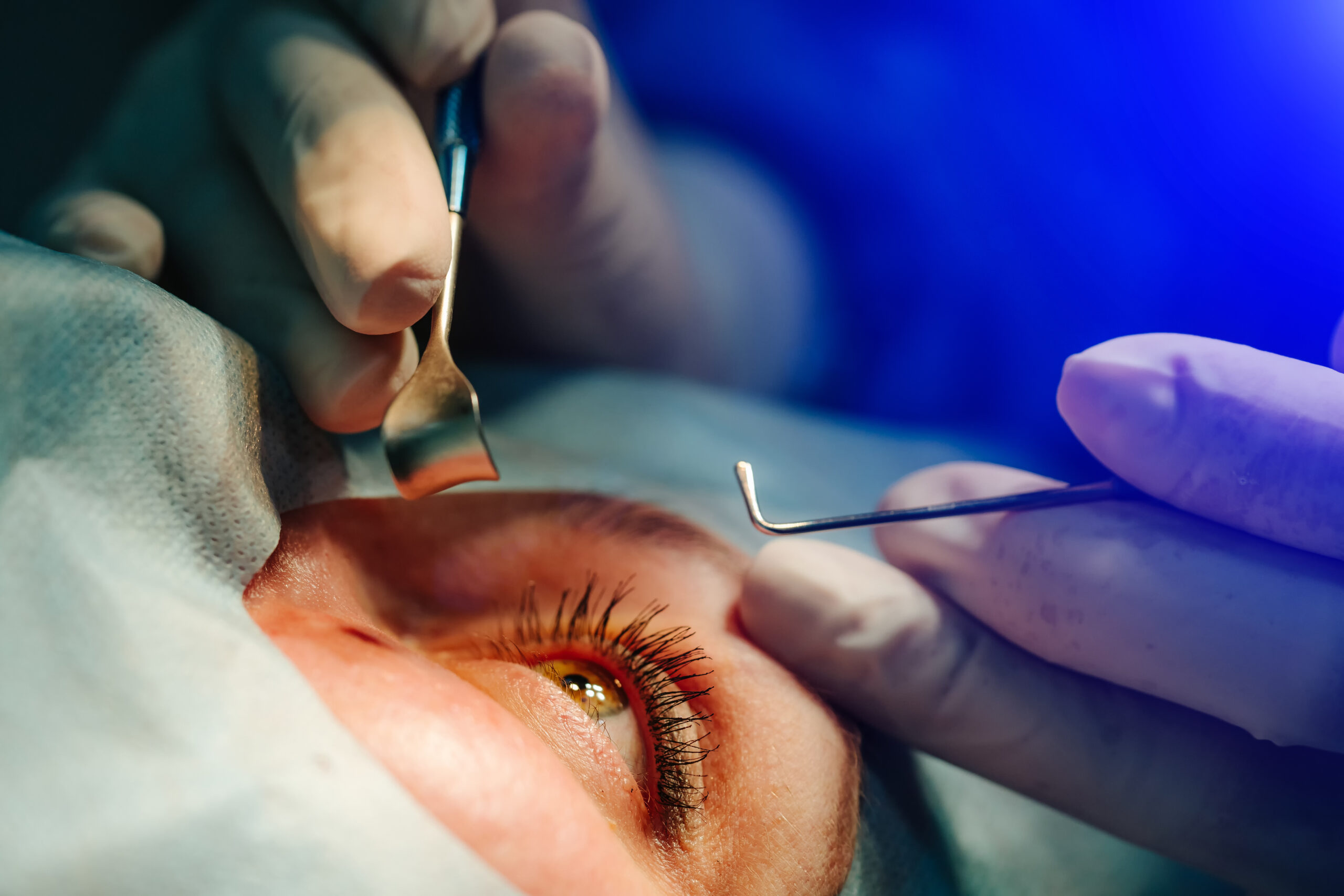 The operation on the eye. Cataract surgery. Vision correction.