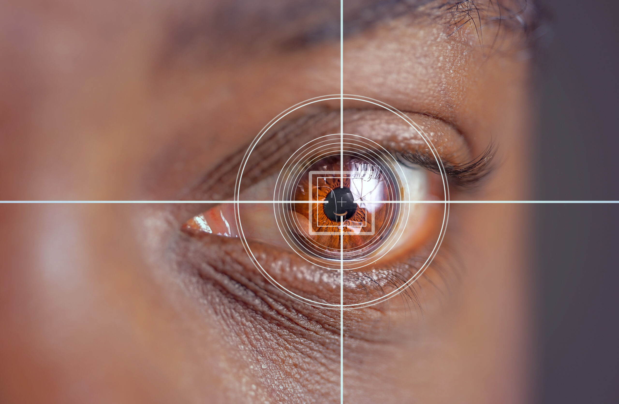 laser and glaucoma eye surgery concept, close up of eye with reticle  or target overlay