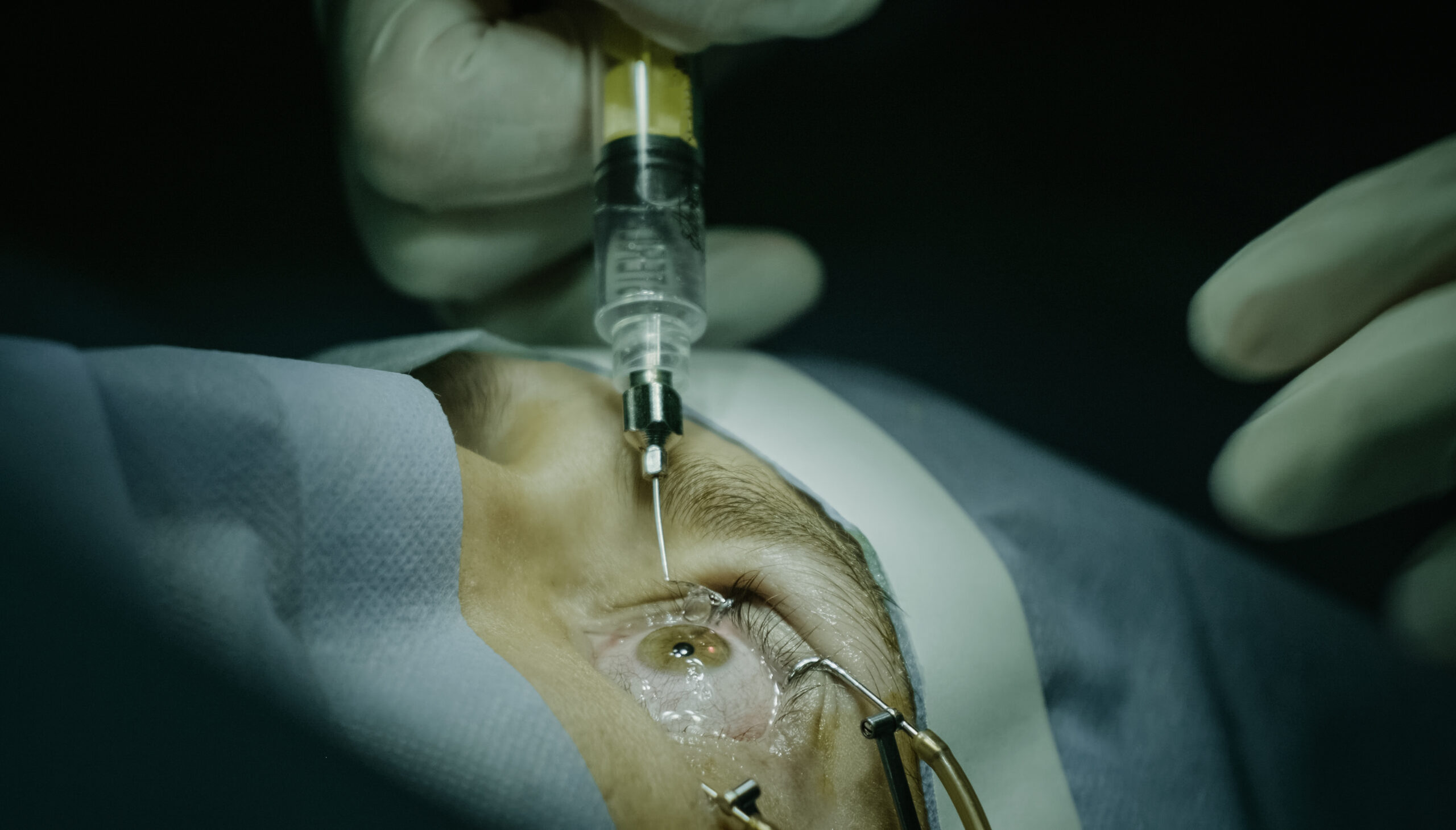 Treatment of an eye in operating room
